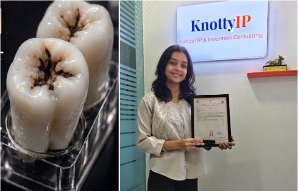 hreya Hanchate 3D Carious Tooth Model Patent